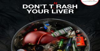 Alcoholic Fatty Liver Disease